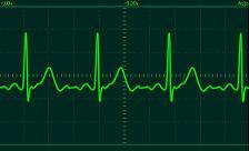 heart beat heart beat